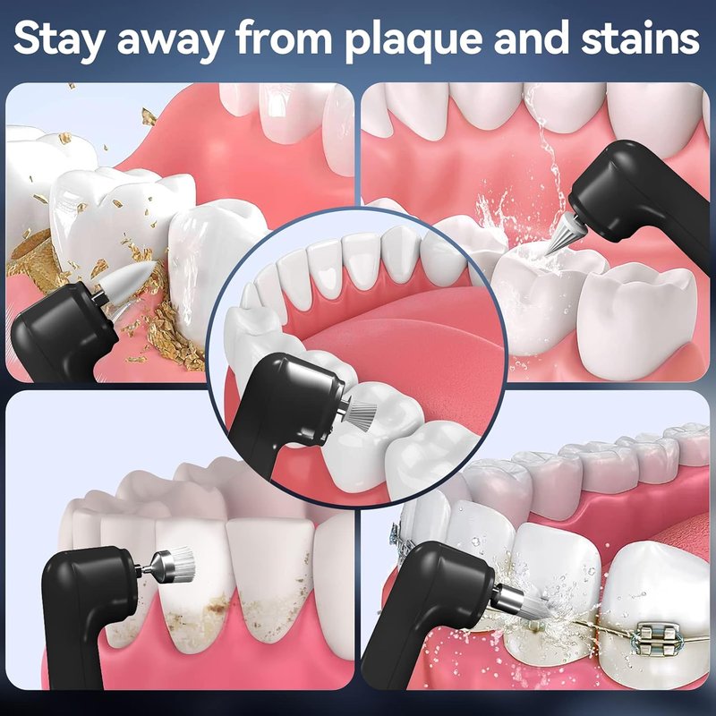 Rechargeable Tooth Polisher - 5 Replacement Heads & Cleaning Modes | USB Waterproof Stain Remover for Adults & Kids