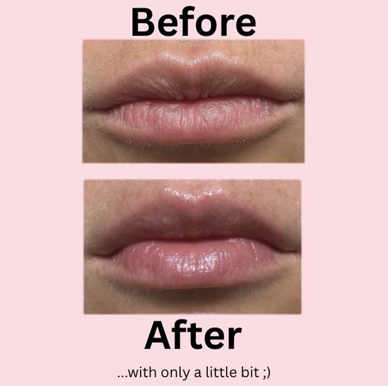 Shea Lip Butter - All-Natural Vegan Lip Balm for Long-Lasting Hydration | Pack of 3, Travel-Sized with Peppermint Oil