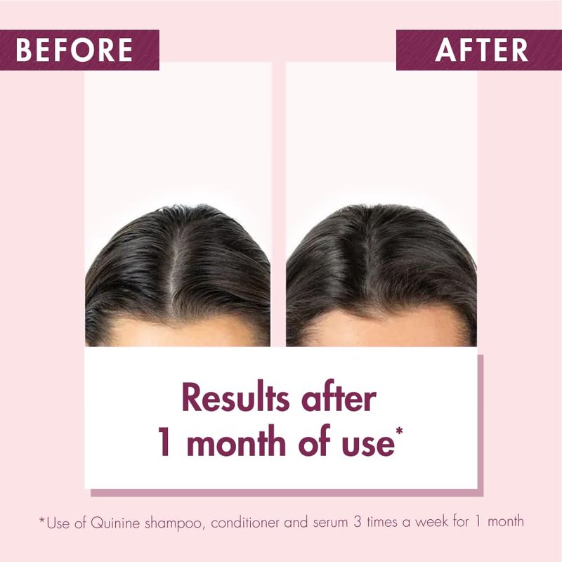 Klorane Shampoo with Quinine and B Vitamins for Thinning Hair, Support Thicker, Stronger, Healthier Hair, Men & Women, 6.7 Fl Oz