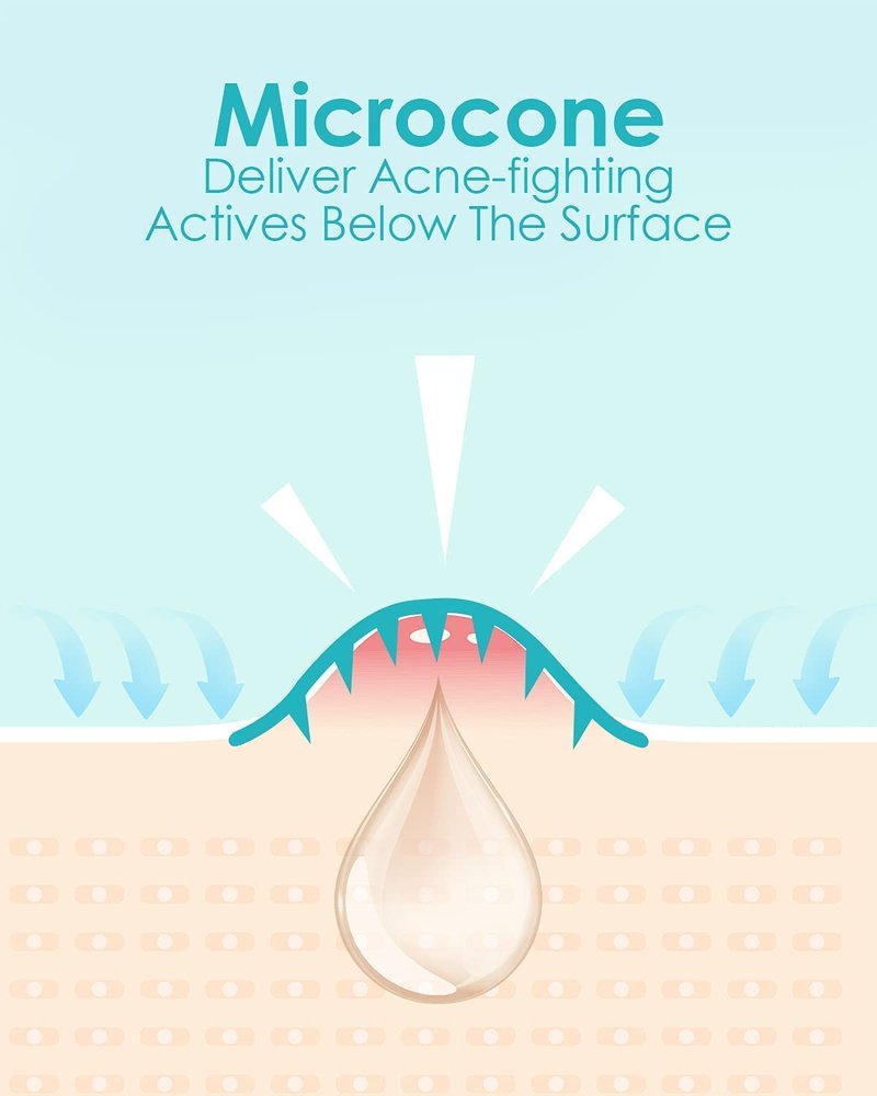 Microdart Acne Patch - Hyaluronate & Salicylic Acid Hydrocolloid Treatment for Deep Blemishes | 72 Patches