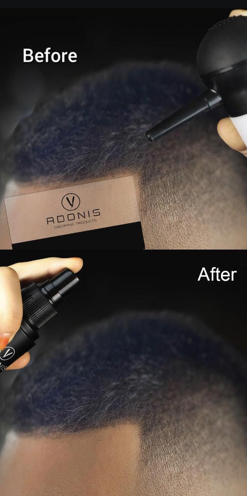 Adonis 5-in-1 Hair Fiber Kit | All-Natural Keratin Fibers, Spray & Applicator for Thinning Hair - Black