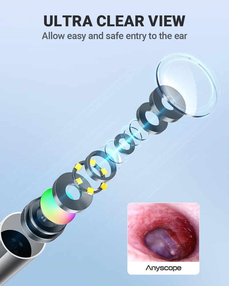 Wireless Otoscope - Dual View Ear Camera with Gyroscope & Light | 3.9mm Ear Scope for Kids, Adults & Pets, iPhone & Android Compatible