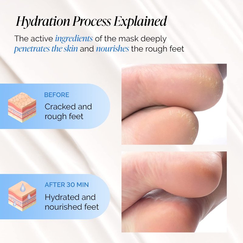Foot Peeling Mask - Hydrating Treatment for Dry & Cracked Feet | 4 Pack