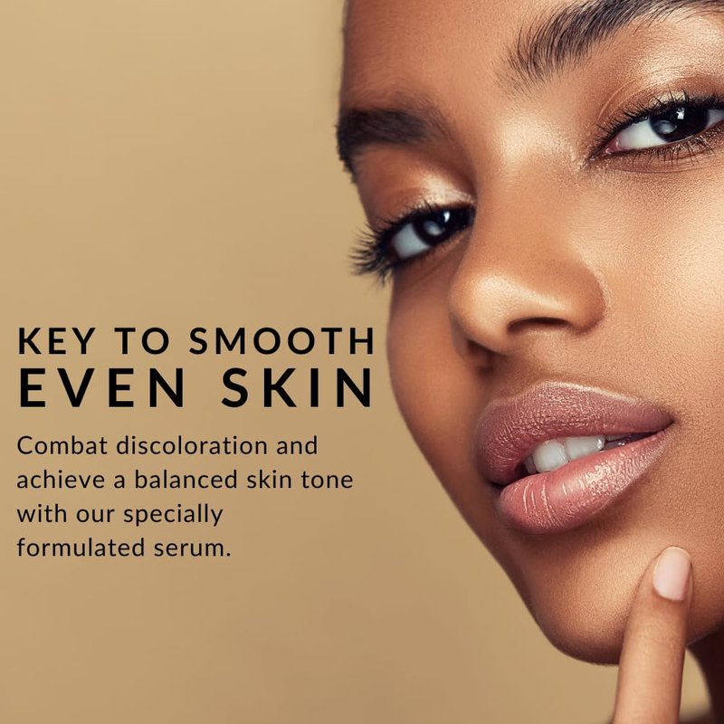 Perfect Tone Moisture Serum by Flori Roberts, Reduces Appearance of Dark Spots, Hyperpigmentation, Lines and Wrinkles, Boosts Radiance