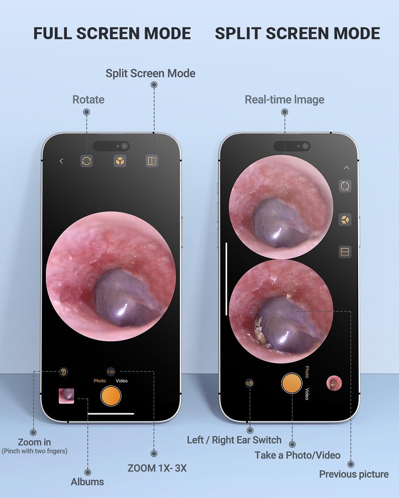 AnyScope HD Digital Otoscope, Video Ear Scope Otoscope with Light, Ultra Clear View Ear Camera with Ear Wax Removal Tools, Compatible with iPhone and Android Devices (Purple) ﻿