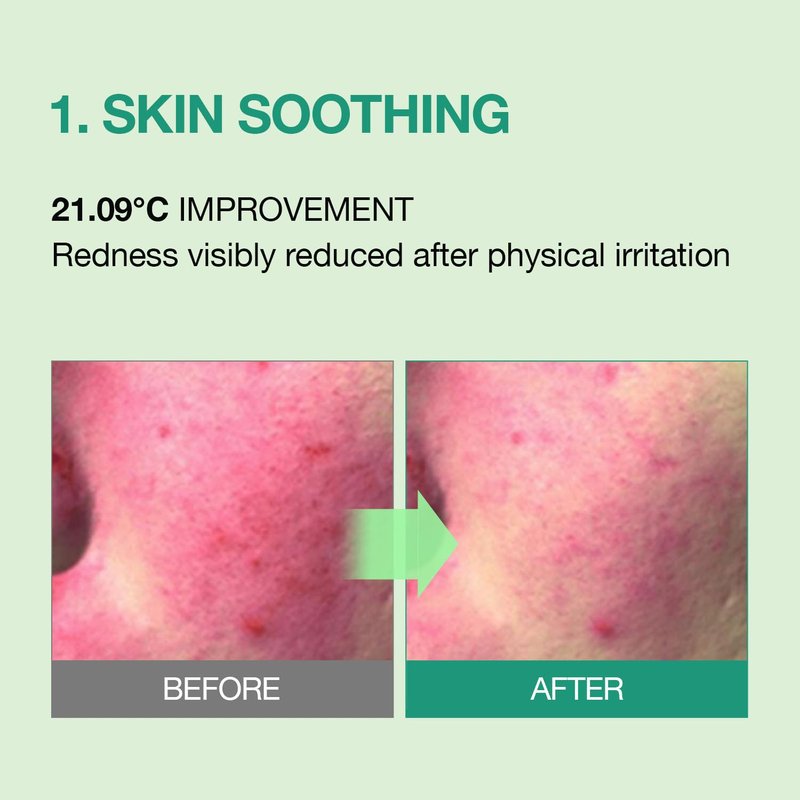 ESSENHERB Tea Tree Soothing In Calming Cream | Tea Tree Moisturizer | Calming Cream for Dry, Sensitive, All Skin Types, Korean Skincare (2.70oz * 2Pack)