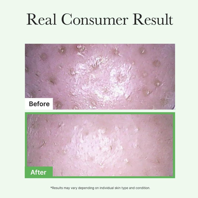 ARENCIA Pore Melt Mochi Makeup-Removing Cleansing Oil, Non-Comedogenic, Rice Amino Acids HD, Vitamin E, Cica, & Ceramide, 6.76 fl oz
