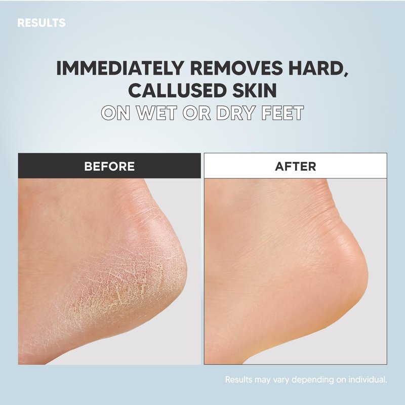 F3 Systems S-Line Emery Foot File & Foot Spray Set, Colossal Double-Sided Pedicure Tool, Effective for Cracked Heel, Ergonomic Design for Easy Grip, Dead Skin Remover, Callus Rasp, Scrubber