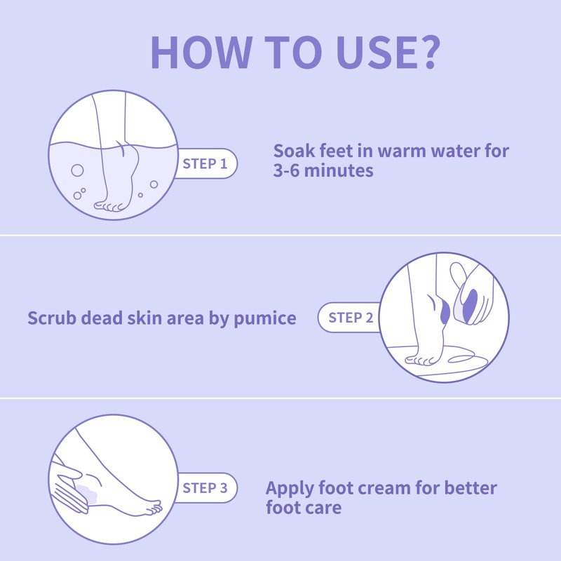 NOVAL Pumice Stone for Feet Callus Remover - 400pcs Bulk Salon Pack with Medium-Coarse Grit Classic Purple
