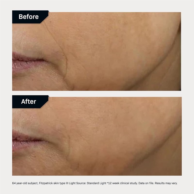 Revision Skincare D·E·J Face Cream - Advanced Anti-Aging Moisturizer | Lifting, Firming & Antioxidant-Rich Formula