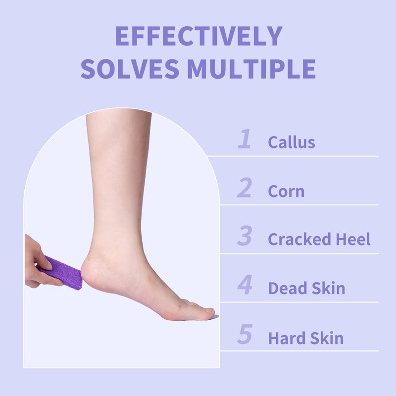 NOVAL Pumice Stone for Feet Callus Remover - 400pcs Bulk Salon Pack with Medium-Coarse Grit Classic Purple
