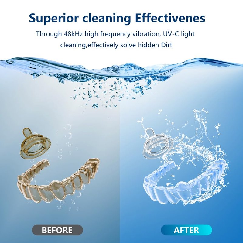 500ML Capacity 48kHz, Updated Version Ultrasonic Retainer Cleaner, Multi-Functional Cleaner Machine For Dentures, Mouth Guards, Braces, Toothbrush, Jewelry, Glasses with Alam Clock Function (black)