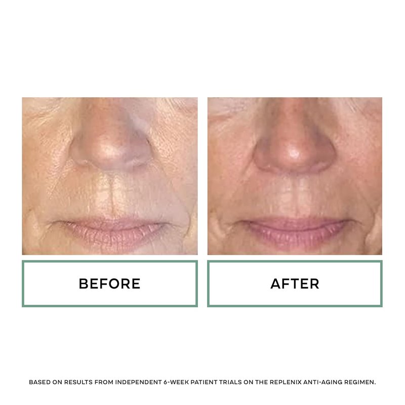 Replenix Age Restore Nighttime Therapy Face Cream - Anti-Aging Moisturizer for Mature & Dry Skin
