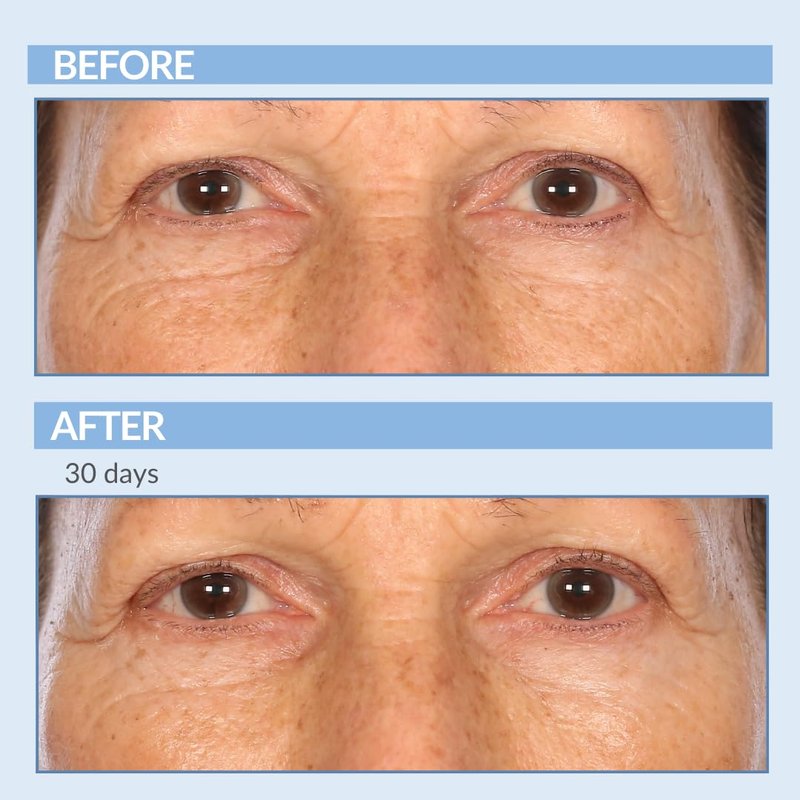 Serious Skincare Retinol A Eye XR Under Eye Cream - Reduce Fine Lines & Dark Circles | 0.5 oz Anti-Aging Treatment