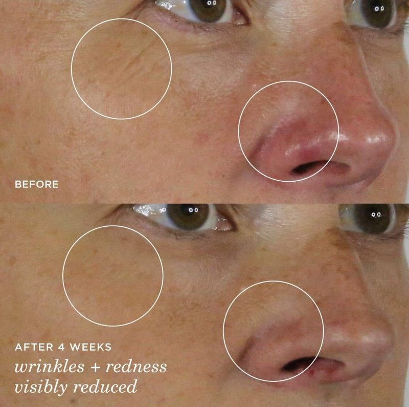 Tatcha The Silk Serum Wrinkle-Smoothing Retinol Alternative | 30 ml / 1 oz