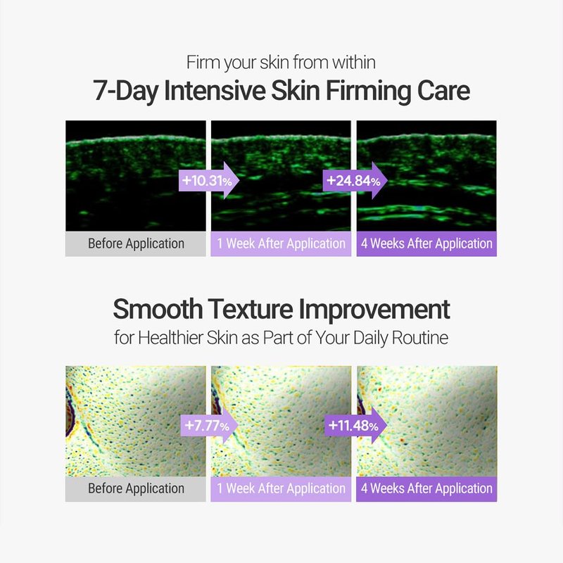 ROVECTIN Retinosine Deep Intense Cream - Retniol 0.15%, Adenosine, Hydrolyzed Collagen, Bakuchiol | For sensitive skin, Korean Skin Care - (1.01 fl.oz, 30ml)