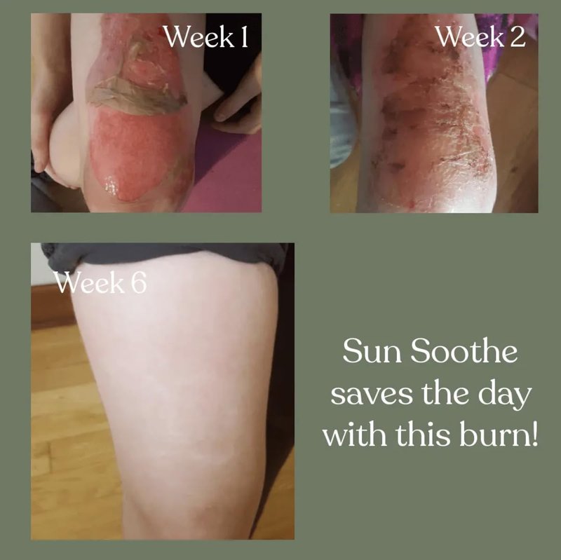 Sun Soothe After-Sun Lotion - Natural Burn Relief & Skin Recovery Cream with Mango Butter, Calendula & Lavender | Family-Friendly 8 oz