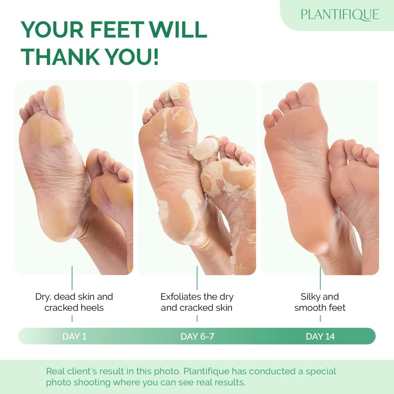 Foot Peeling Mask - Hydrating Treatment for Dry & Cracked Feet | 4 Pack