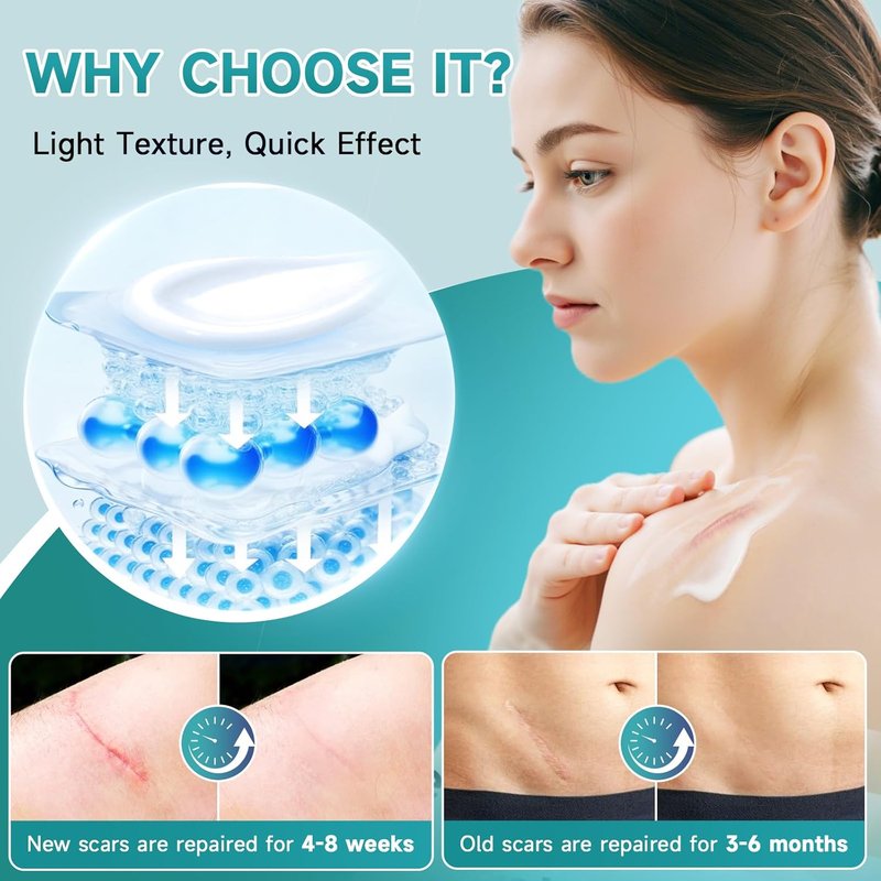 Advanced Scar Cream - Silicone Gel for Surgical Scars, Stretch Marks & More | 1.7 oz (50ml)