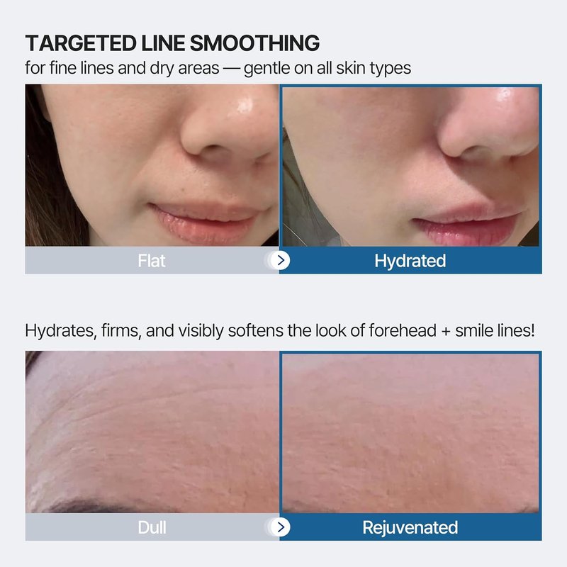 Wrinkle Patches for Forehead & Smile Lines - 36 PCS Hyaluronic Acid, Collagen, Peptides | Smoothing & Firming Treatment