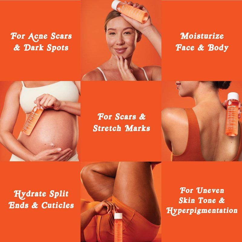 Bio-Oil Skincare Body Oil Serum for Scars and Stretch Marks, Face and Body Moisturizer with Vitamin E & A for Sensitive Dry Skin, Dermatologist Recommended, Non-Comedogenic, 4.2 Oz