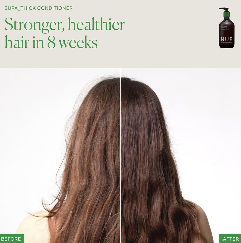 The Nue Co. Supa Thick Conditioner - Hydrating Hair Growth Conditioner for All Hair Types - Strengthens Roots & Improves Scalp Health - Vegan & Sulfate Free Formula - Nourishing Hair Care | 8.45 fl oz