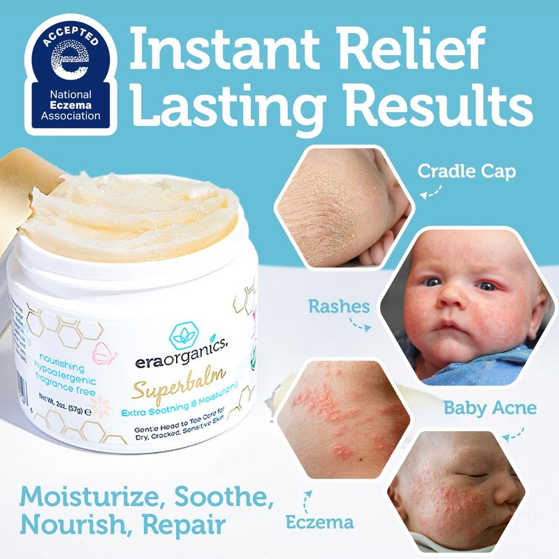 Era Organics Healing Ointment for Babies - Organic Moisturizer for Eczema, Cradle Cap & Rashes | 2oz