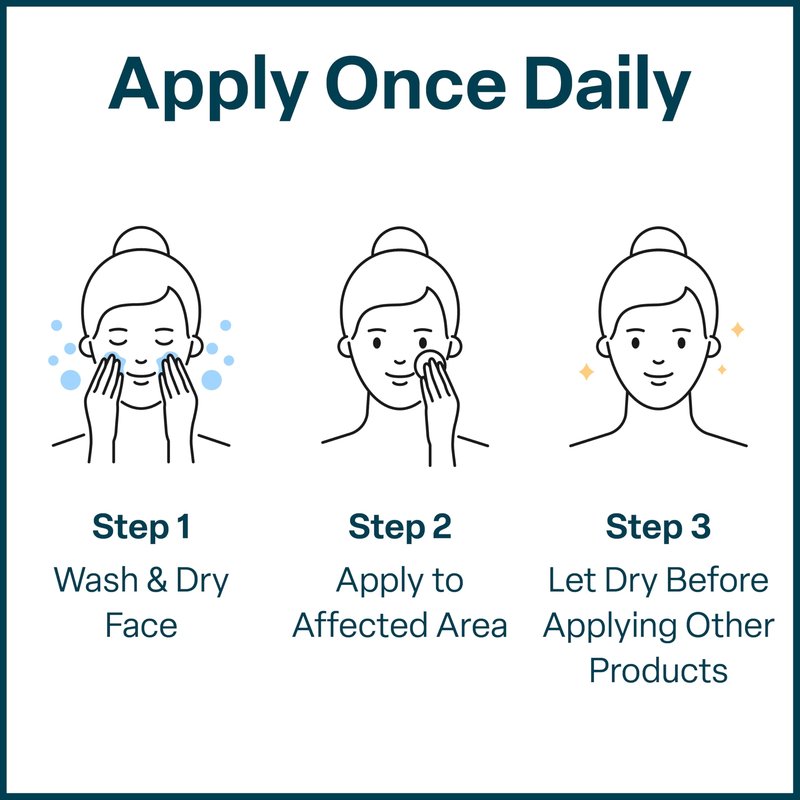 QRxLabs Salicylic & Glycolic Acid Acne Clearing Pads - 2% Salicylic & 10% Glycolic Acid - Exfoliating Pads for Acne, Bacne, Butt Acne, Body Acne - Daily Pads - 50ct