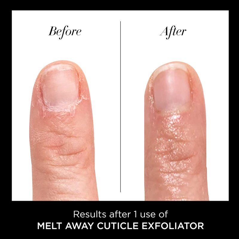 butter LONDON Cuticle Remover Liquid, Melt Away - Cuticle Oil Exfoliator & Softener Gently Removes Dry, Overgrown Cuticles for Healthy Looking Nails - Fast-Acting & Pain-Free Formula - 0.4 Fl Oz