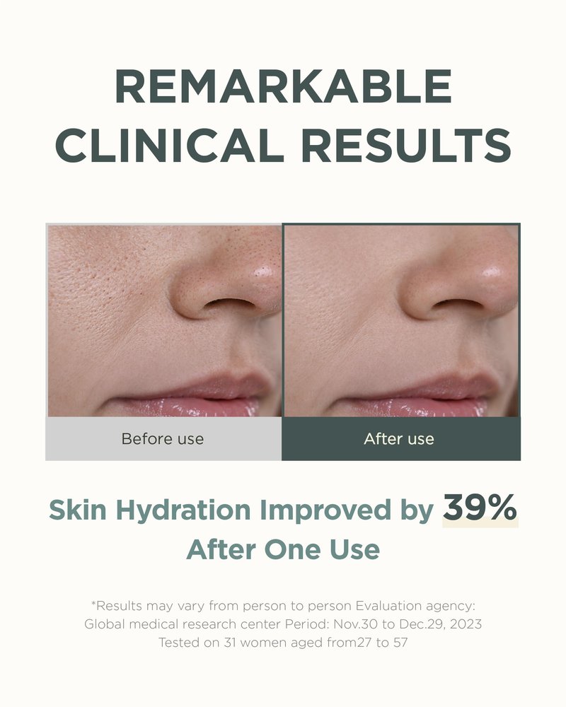OURWHY Heartleaf Hydra Calming Serum (1.35fl oz) - Soothing & Hydrating Serum for Sensitive Skin. With Heartleaf Extract, Hyaluronic Acid & Panthenol