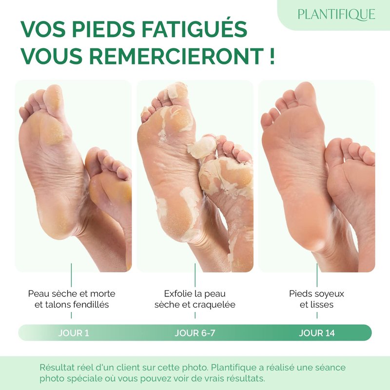 Plantifique Foot Peeling Mask - Exfoliating Clay Mask for Baby Soft Feet | 2 Pack, 110g