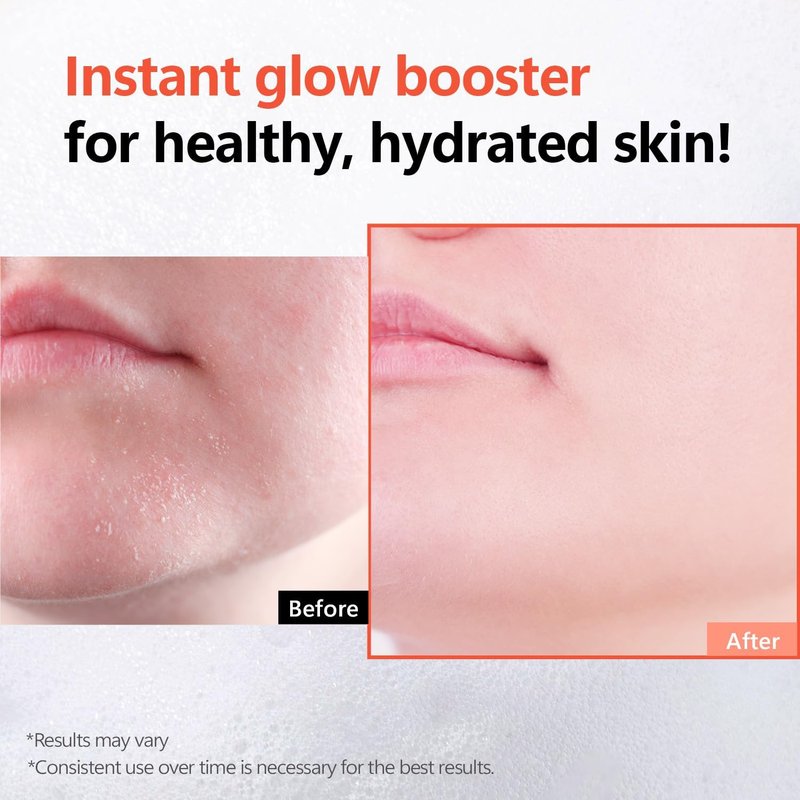 Rice Glow Bubble Toner - Milky Hydrating Toner with Niacinamide & Rice Extract | 5.07 fl oz for Sensitive Skin