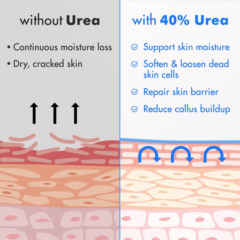 Ebanel Urea Cream 40% plus Salicylic Acid 2%, Foot Cream for Dry Cracked Heels Feet Knees Elbows Hands, Foot Dead Skin Cuticle Callus Remover Toenail Softener, Keratolytic Skin Barrier Repair Cream