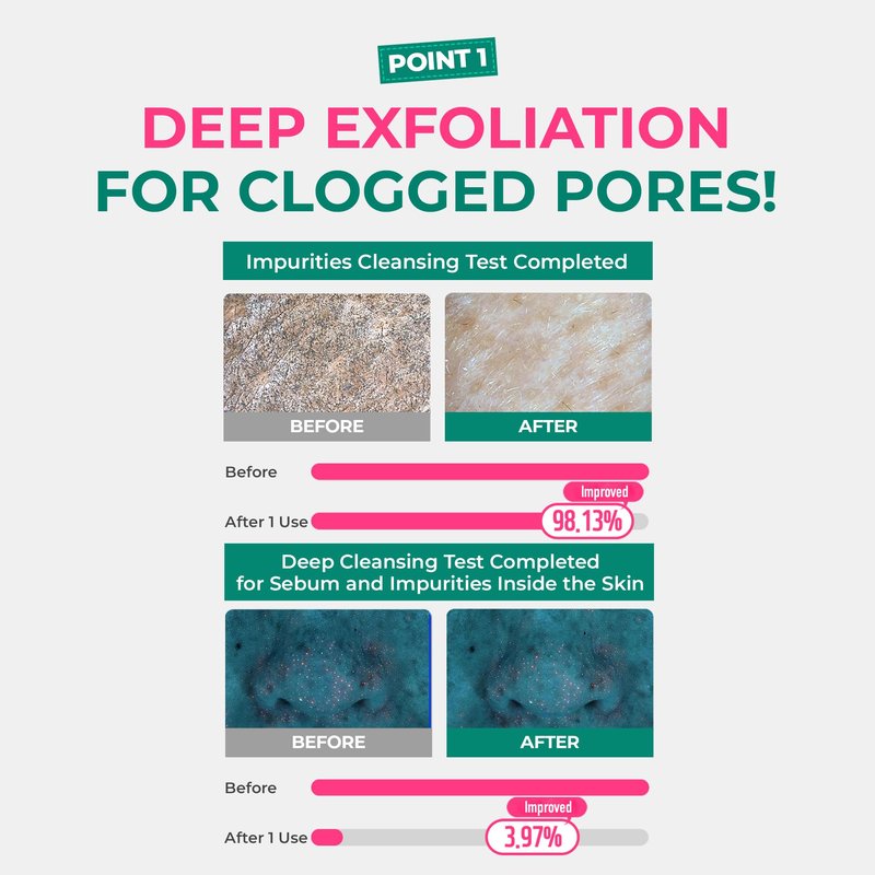 BRING GREEN Tea Tree Cica Pore Clay Mask 100g, Deep Cleansing Wash Off Pack for Blackheads & Excess Sebum