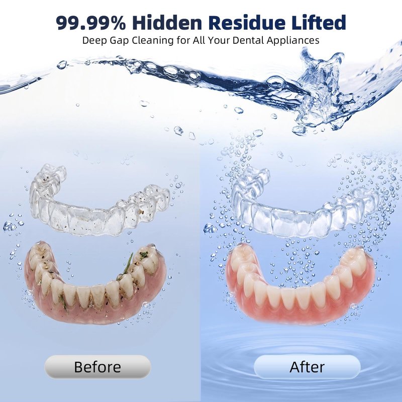 Ultrasonic Retainer Cleaner Machine, Denture Cleaner for Aligners Night Guards Braces Mouth Guards Toothbrush Heads，All-in-One Dental & Jewelry Cleaner, 45kHz 200ML, Dual Modes