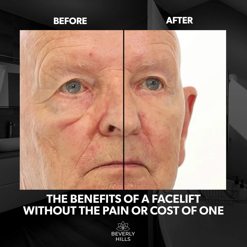 Beverly Hills Mens Instant Facelift and Eye Serum Treatment for Dark Circles, Puffy Eyes, and Wrinkles