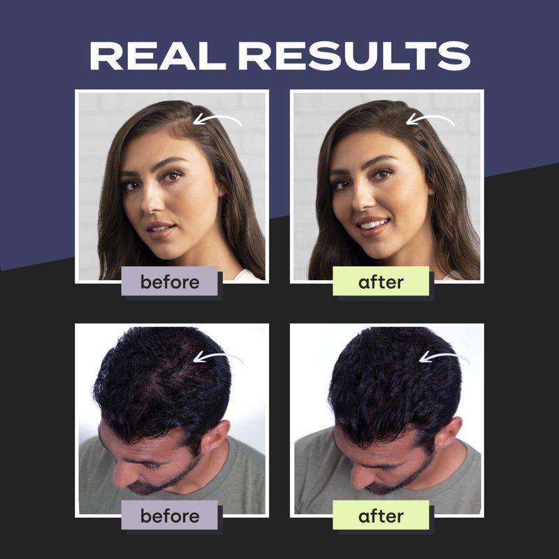 Toppik Hair Building Fibers, Auburn, 12g Fill In Fine or Thinning Hair, Instantly Thicker, Fuller Looking, 9 Shades for Men & Women, Keratin Protein Formula