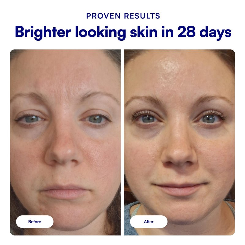 Bliss Vitamin C + Tri-Peptide Face Serum - Stabilized Vitamin C for Dark Spots, Fine Lines & Firmness - Brightening Serum with Collegen Boosting Peptides, Hyaluronic Acid, Squalane - 1 Fl Oz