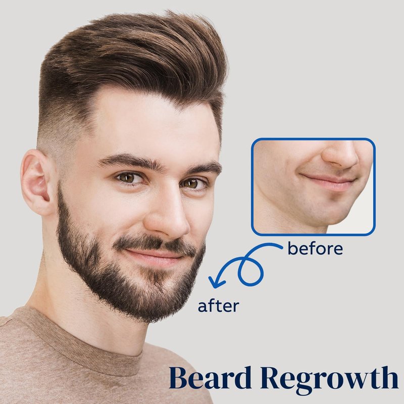 5% Minoxidil Spray for Men and Women, Minoxidil for Women Hair Growth, Minoxidil for Men Hair Growth Spray 4PCS.