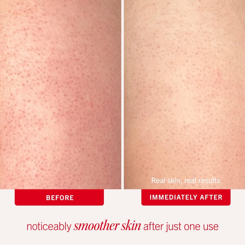 First Aid Beauty Smooth + Juicy Body Scrub Kit: KP Bump Eraser Body Scrub with 10% AHA, Daily Exfoliation Keratosis Pilaris Set to Help Reduce Chicken Skin Bumps; Strawberry, Peach, & Original (2 oz)