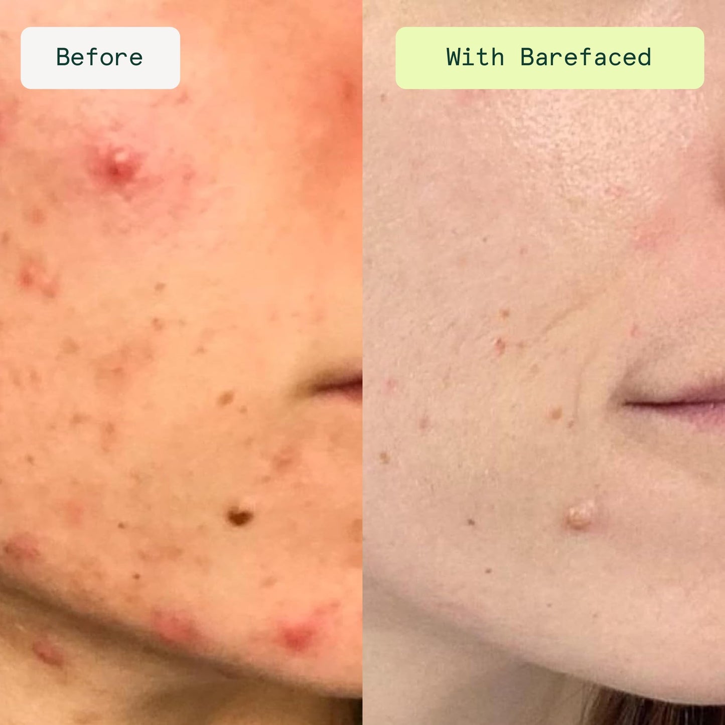 Barefaced Toning Pads II (60 Count) Exfoliating and Resurfacing Face Pads w/ 5% Glycolic Acid & Salicylic Acid, Helps with Brightening & Cleansing Skin, Clears Pores, Reduces Fine Lines and Wrinkles