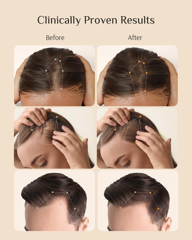 DR ZERO REDENICAL Hair Growth Shampoo for Women | MONDE SELECTION Gold Winner | Swiss Patent Redensyl | Clinically Proven Anti-Thinning | Japanese-Made Volumizing & Repair Shampoo, Gifts for Women
