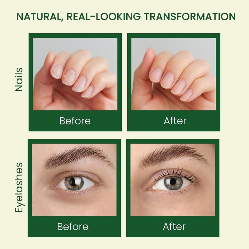 Pure Castor Oil - Cold Pressed 100% Natural Oil for Hair Growth, Skin & Nails | 10oz with Dual Mascara & Dropper