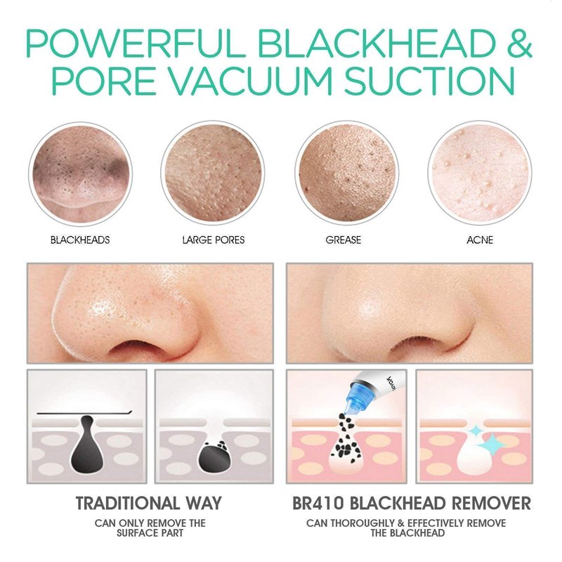 Blackhead Remover Pore Vacuum - Rechargeable Facial Cleansing Brush for Deep Cleaning & Exfoliation