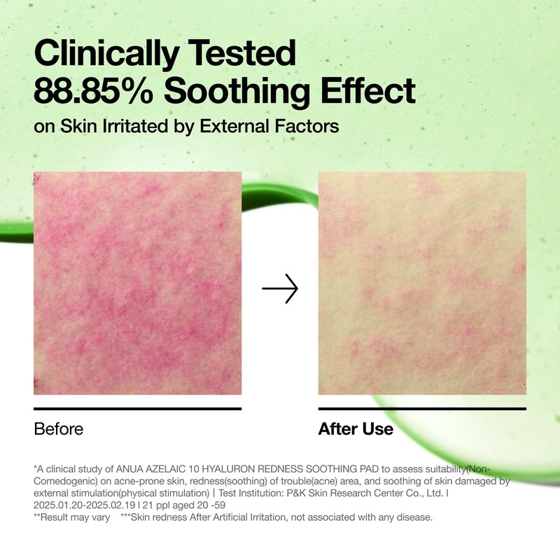 ANUA Azelaic Acid 10 Hyaluronic Acid Soothing Toner Pads, Hydrating Facial Mask for Redness, Pore & Blemish Care, Quick & Easy Stretchable Formula, Korean Skincare, 90 Pads