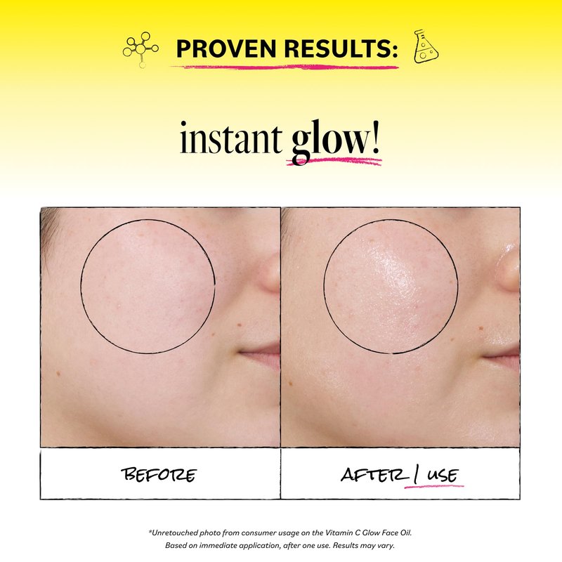 Derma E Vitamin C Glow Face Oil, 1 Fl Oz, Nourishes, Brightens and Illuminates for Radiant Skin, Moisturizing Vitamin C Oil with Turmeric, Seabuckthorn and Red Raspberry