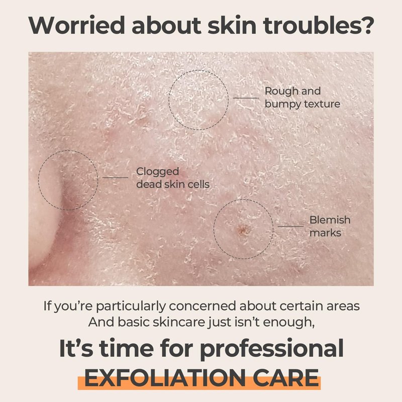 BnD AHA Marshmallow Exfoliating Body Scrub, 6.76 fl.oz-Korean Beauty