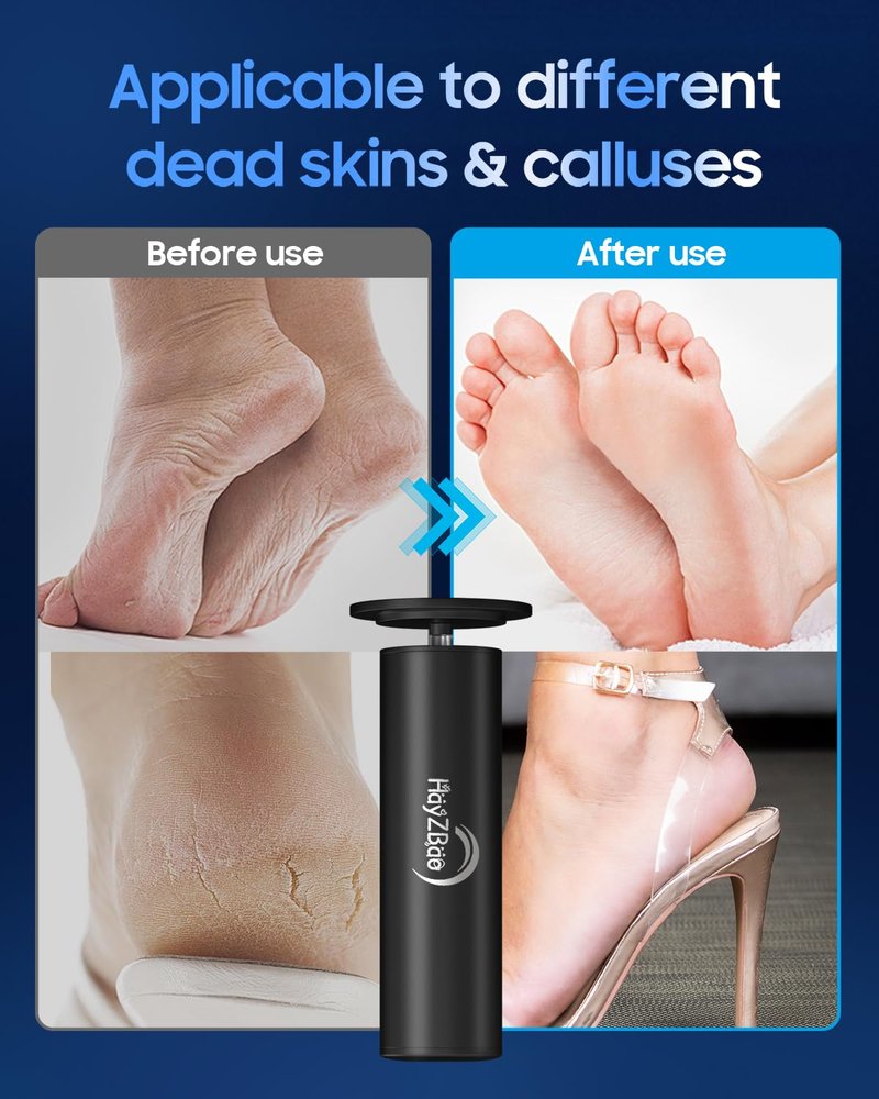 HayZBao Electric Foot Callus Remover - Electric Callus Remover for Feet,Foot Scrubber with 60 Pcs Sandpaper Discs,Professional Pedicure Tool for Dead Skin - Black