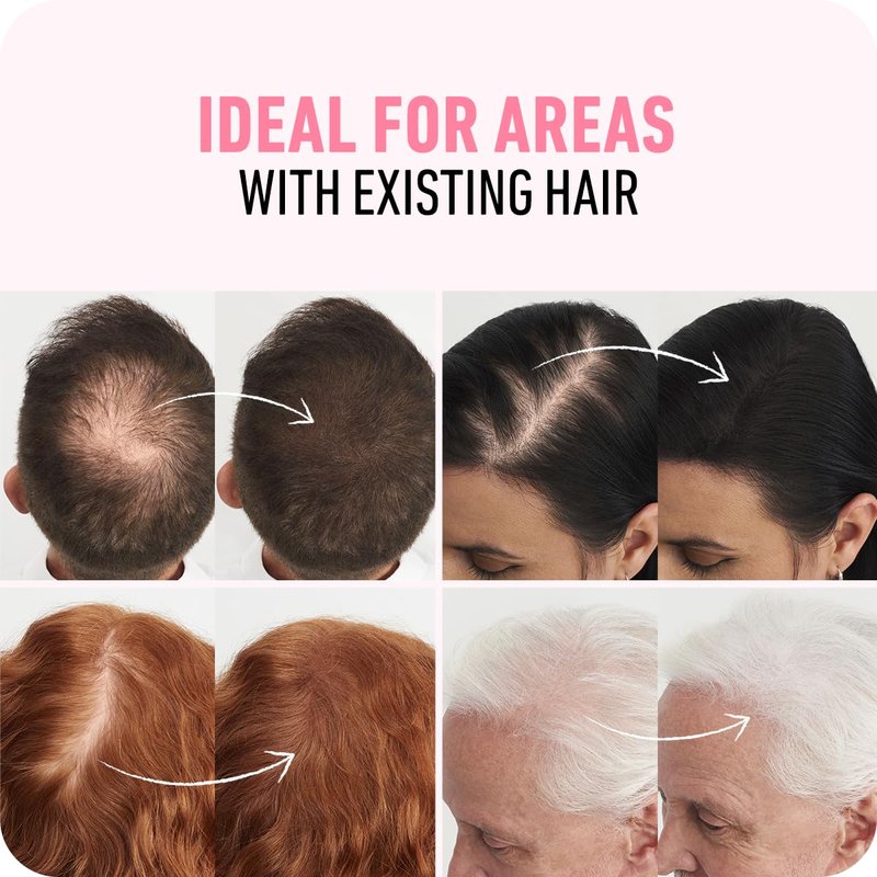 BOLDIFY Hair Fibers (28g) - Fill In Thinning and Fine Hair for an Instantly Fuller, Thicker Look - 14 Shades for Women & Men - Dark Brown