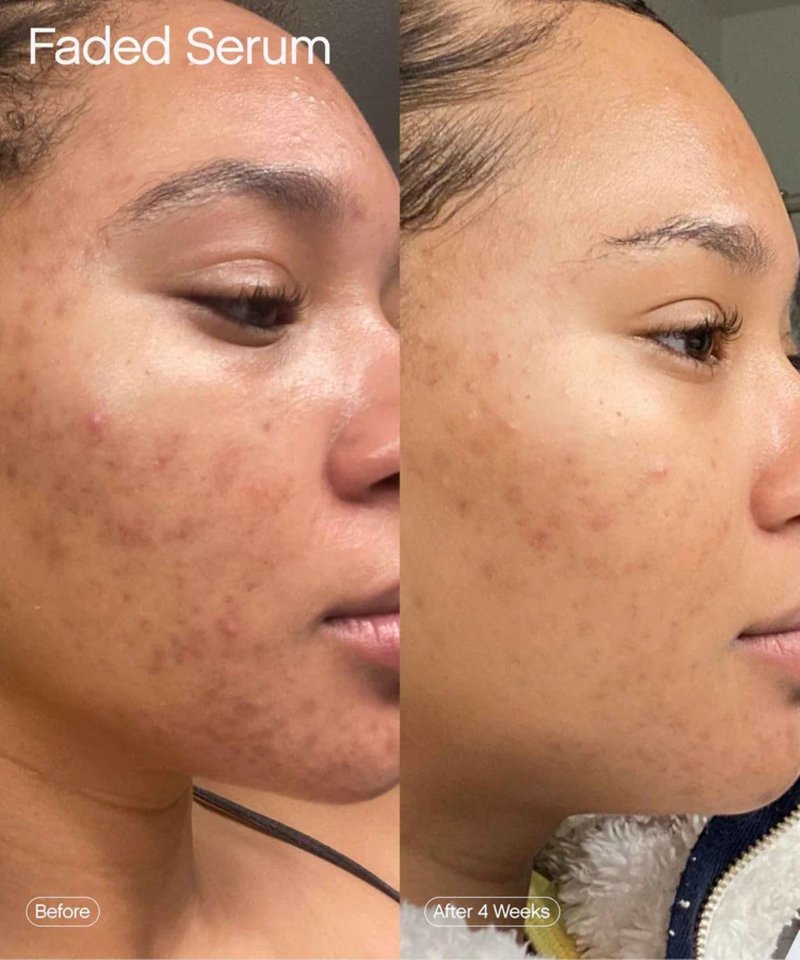 Topicals Faded Brightening Serum - Reduces Discoloration & Scars | Kojic Acid & Niacinamide | 1.7 Fl Oz